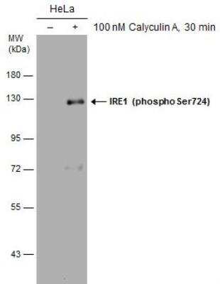 Western Blot: IRE1 alpha [p Ser724] Antibody [NBP3-12123]